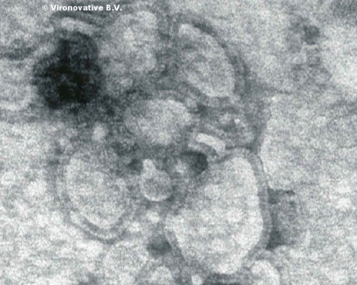 Clinical Symptoms hMPV ViroNovative hMPV patent holder